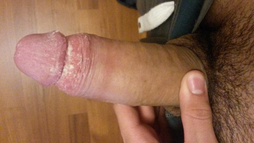 Hi, I’m Matteo, 19. Hope that you like my photo, it’s 3 days since i washed under my dick. &mdash;&mdash;&mdash;&mdash;&mdash;&mdash;&mdash;&mdash;&mdash;&mdash;&mdash;&mdash;&mdash;&ndash; Thanks Matteo! You have a gorgeous cock and love all that smelly cheese under your foreskin. Would love to smell and taste it :) More smegma at smegmalicker.tumblr.com.