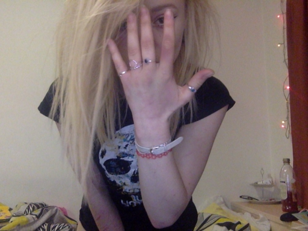 shall we talk about wtf ive managed to do to my hand. or&hellip;.. 