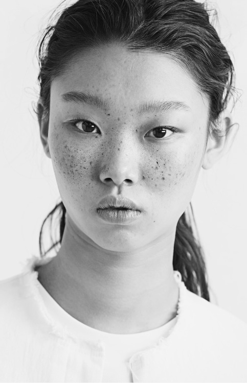 Freckled Asian 103