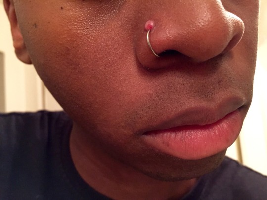 Gross Nose Ring Piercing Bump Yahoo Answers