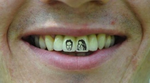A British man has ruined his chances of ever getting laid by tattooing Prince William and Kate Middleton to his teeth.
